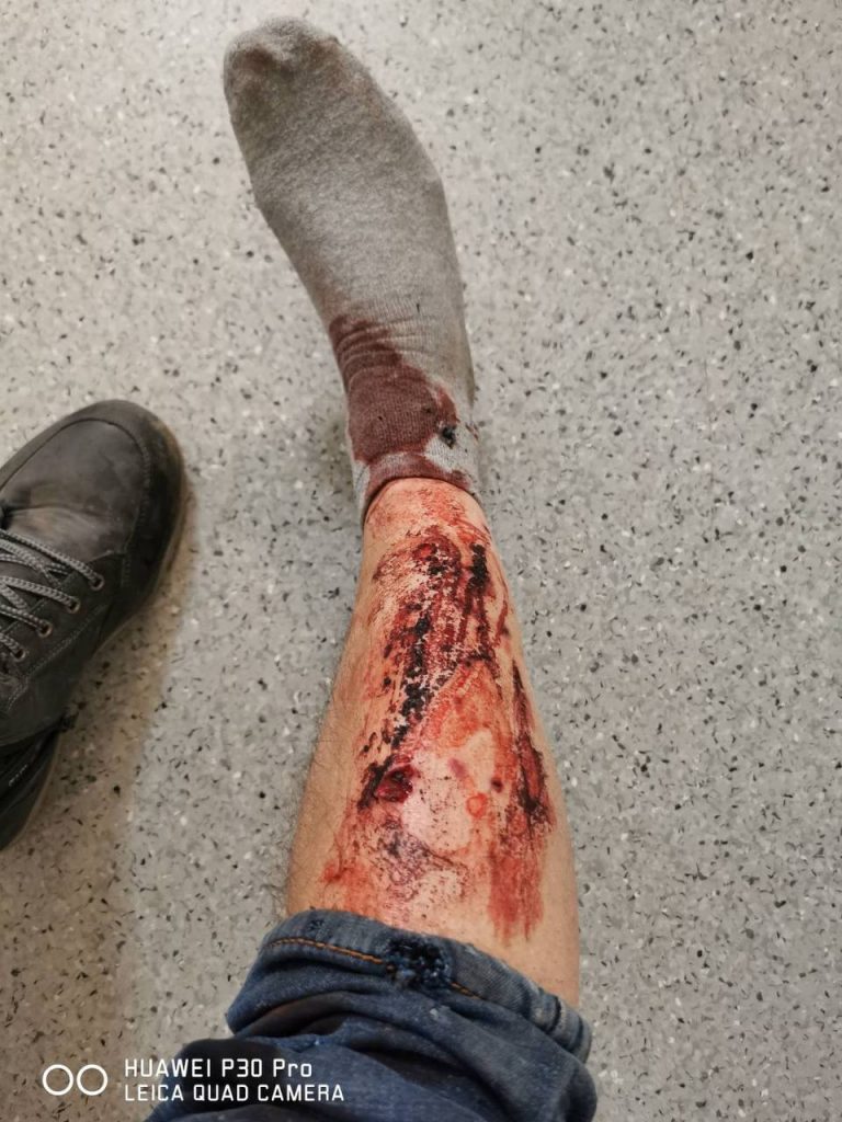 Ранение ноги Анатолия Геращенко. Горящая после расстрела машина. Фото с телефона Анатолия Геращенко