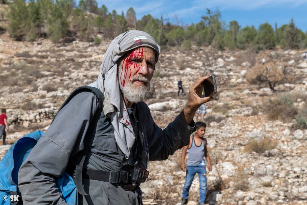 Арик Ашерман после избиения поселенцами в ноябре 2021 года. Раввин помогает палестинцам