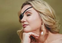 Мой бывший выбил мне глаз